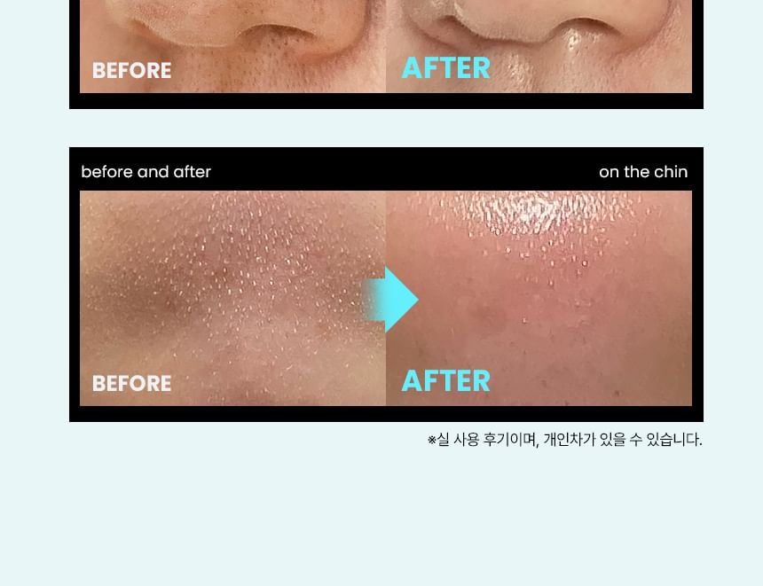 ilso - Super Melting Sebum Softener