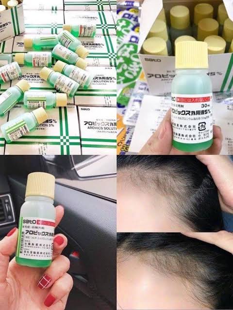 Sato Arovics Solution 5% Carpronium chloride - 30mL (hair loss) šÆšµ Japan