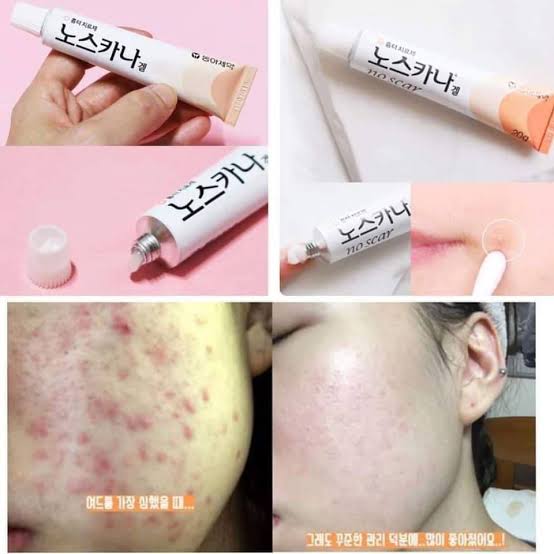 Noscarna Dark Scars Faded Cream