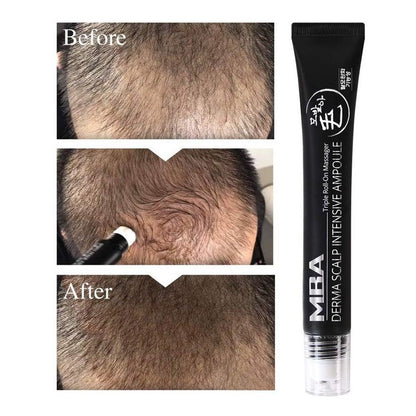 DAYCELL MBA MoBalA Derma Scalp Intensive Ampoule Triple Roll-On Massager Hair Growth Essence 20ml