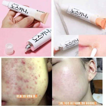Noscarna Dark Scars Faded Cream